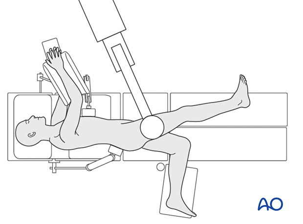 Pr130 Lateral position