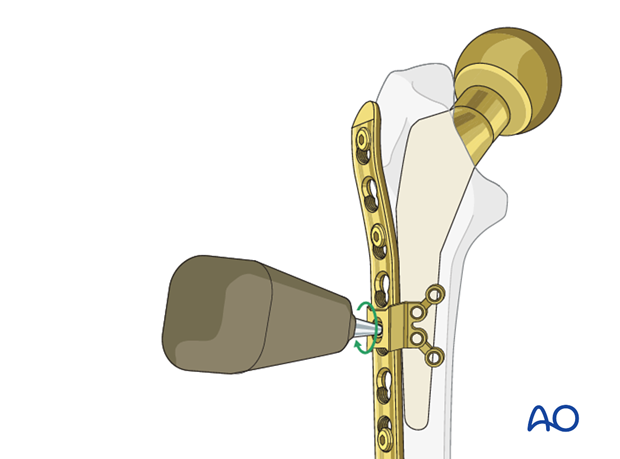 Locking attachment plate positioning