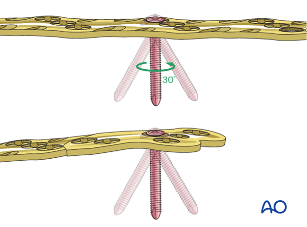 Variable angle screw fixation