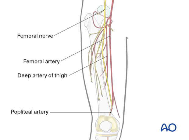 Upper leg safe zones