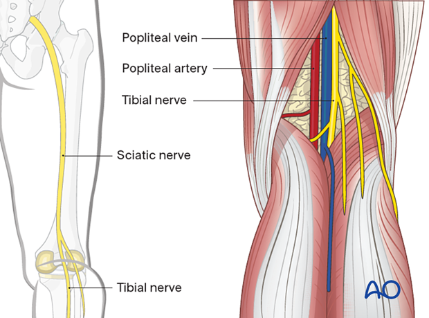 Sciatic nerve