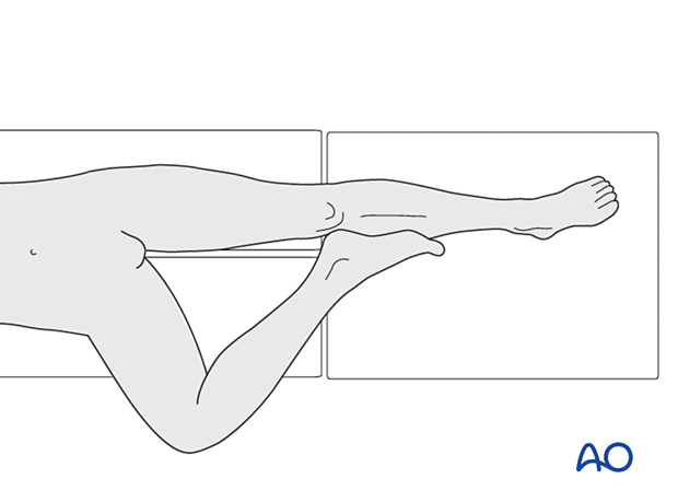 Figure of 4 position