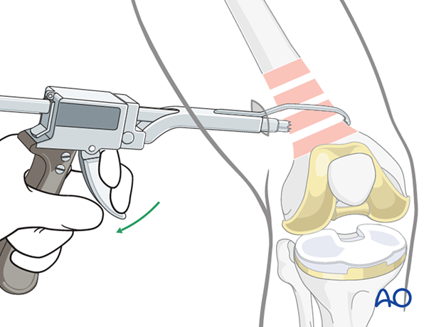 Collinear clamp