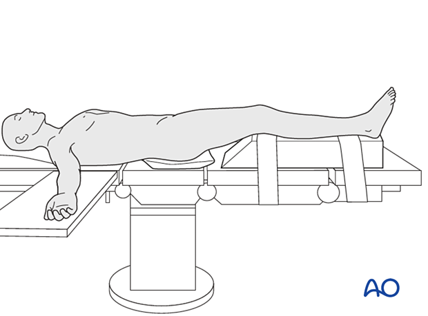 Patient supine