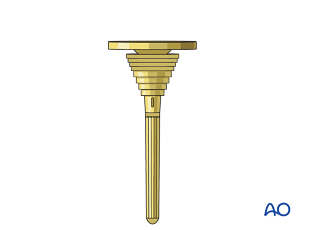 Supplemental metaphyseal fixation