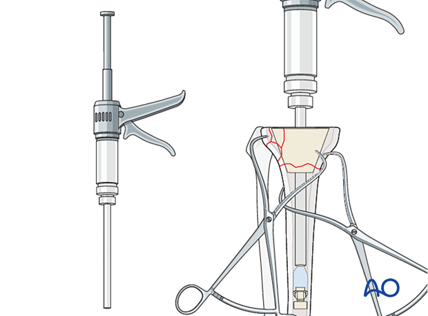 Cementation