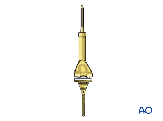 Distal femoral replacement prosthesis