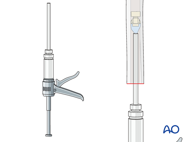 cementation