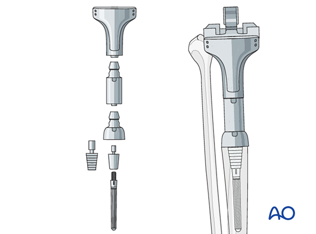 Trial components