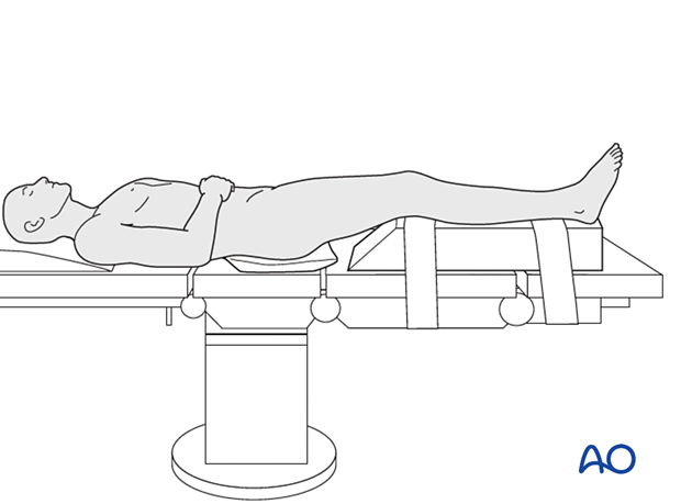 Supine position