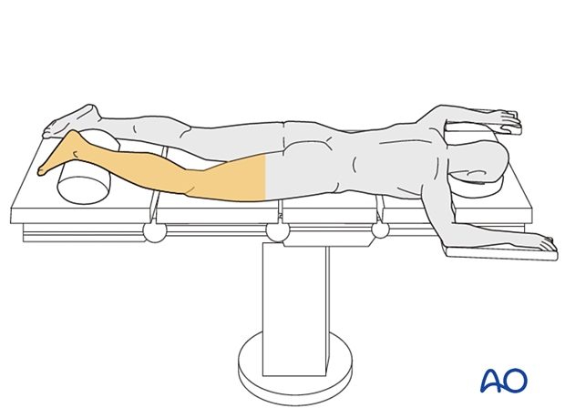 Pr140 Prone position