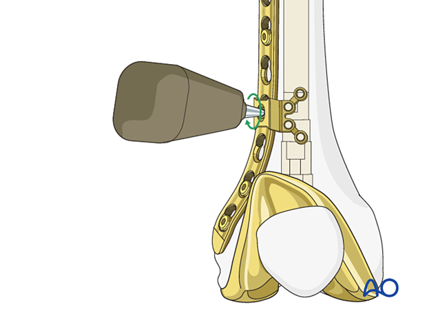 Locking attachment plate positioning